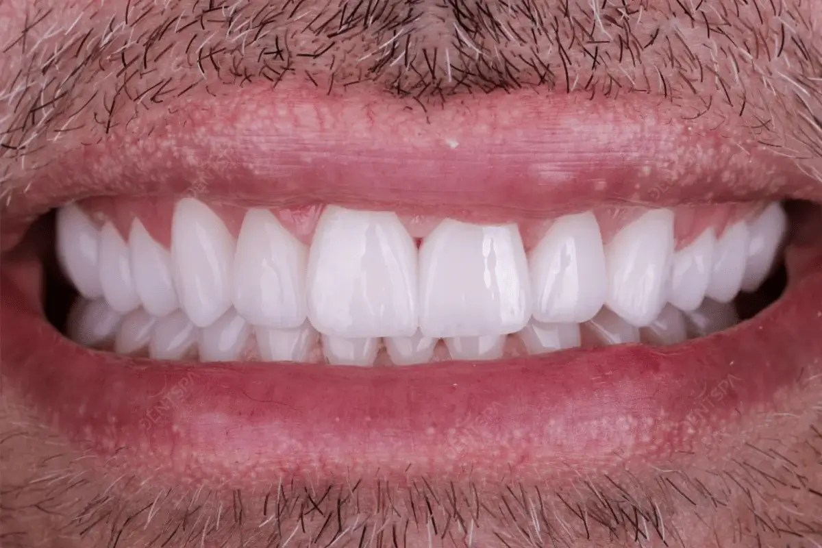 After-T After-T